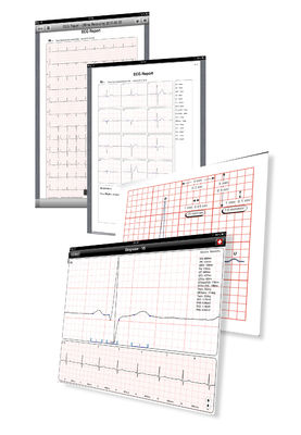 Electrocardiography Test Machines 12 Lead Hospital iPad ECG Monitors