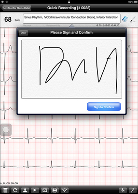 Portable Digital ECG Machine Heart Rate ECG Electrocardiography Test  For  iOS